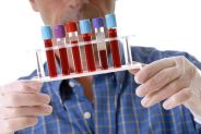 analisi del sangue HIV